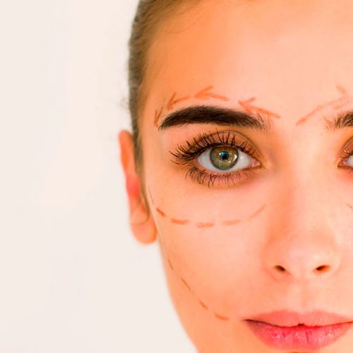 retensado facial alicia f hidalgo