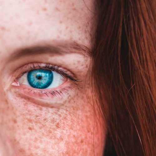 Medicina-estetica-facial-manchas-solares